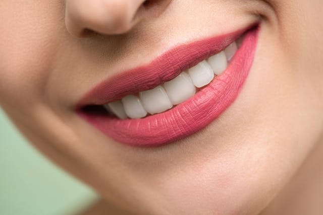 How to Whiten Sensitive Teeth Safely Without Discomfort